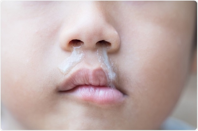 Bé bị ho, sổ mũi có cần dùng kháng sinh?