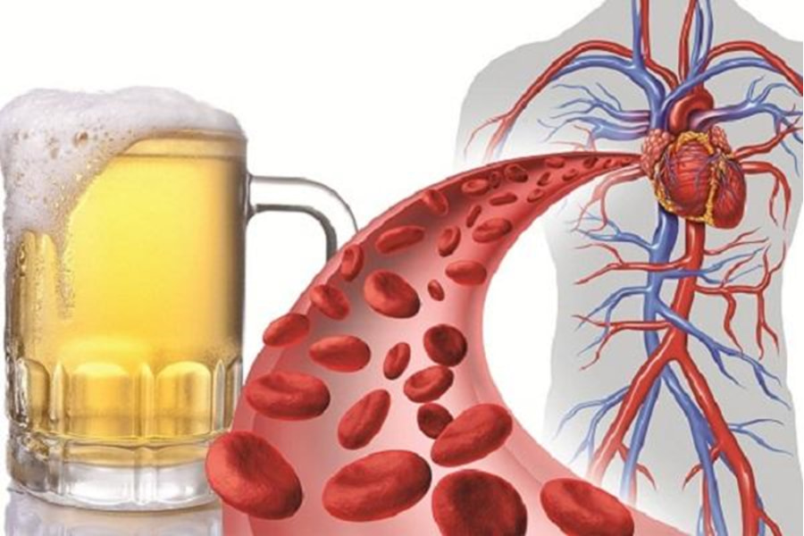 Rượu bia nói riêng và đồ uống có cồn nói chung ảnh hưởng tới hệ tim mạch ở nhiều mức độ khác nhau