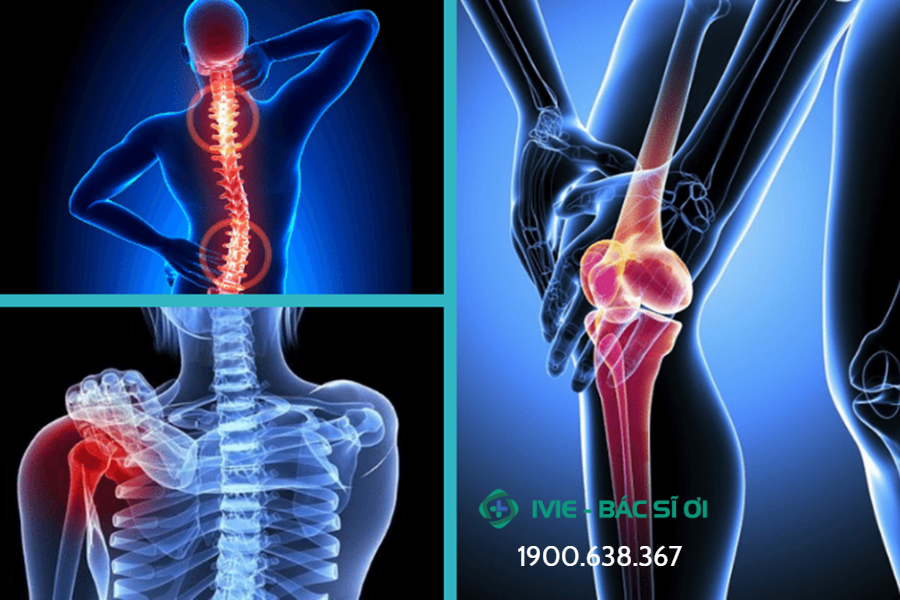 Khám cơ xương khớp là khám, chẩn đoán và điều trị các bệnh về cơ, xương, khớp, bằng các phương pháp nội khoa 