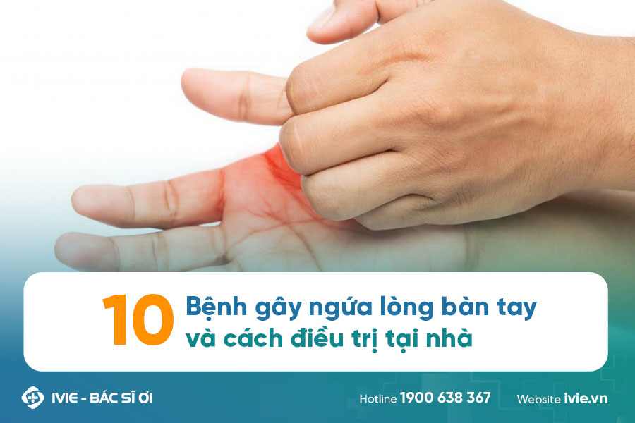 10 Bệnh gây ngứa lòng bàn tay và cách điều trị tại nhà