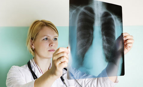 Một số trường hợp người bệnh mắc tình trạng viêm phổi.