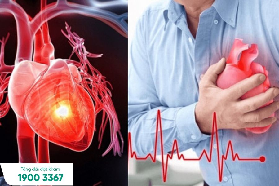 Bệnh tim mạch, động mạch vành đáng báo động ở Việt Nam