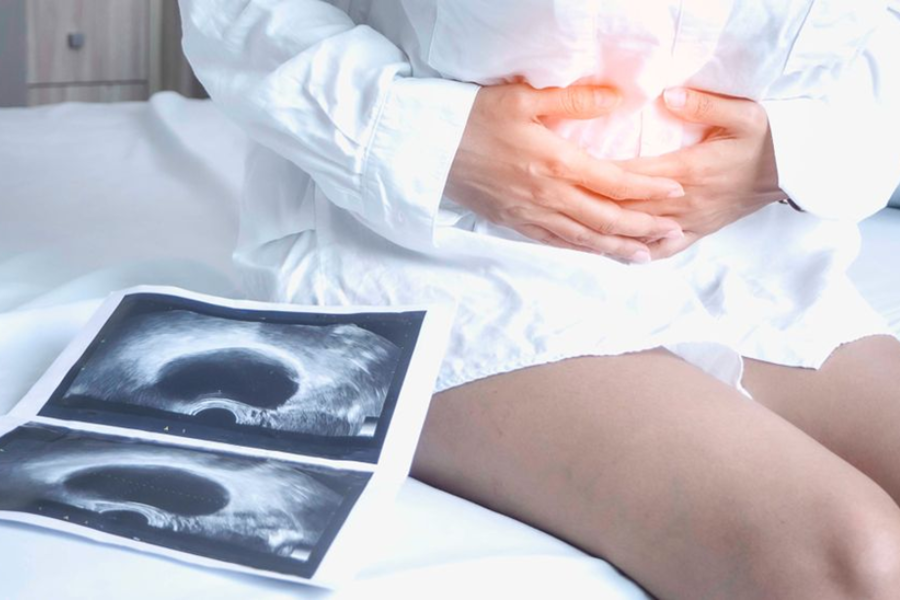 Biến chứng u nang buồng trứng phụ thuộc vào tuổi thai