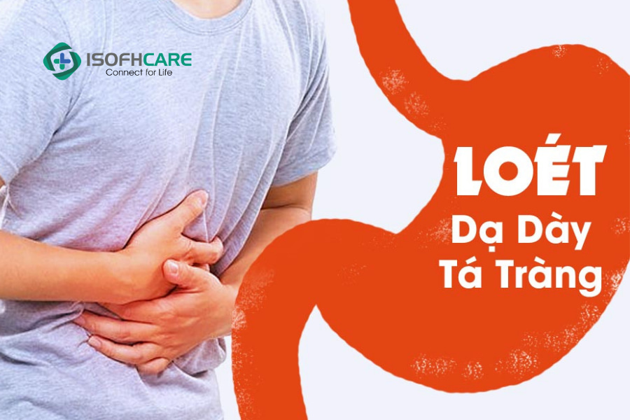 Vì vậy sử dụng nhiều rượu bia thì nguy cơ loét tá tràng càng cao.