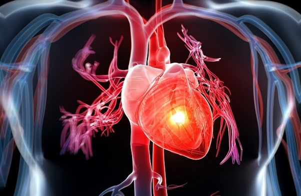 Những biểu hiện bệnh tim mạch cần nhanh chóng cấp cứu nếu...
