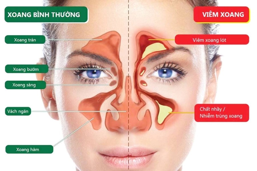 Các bệnh về tai mũi họng thường gặp