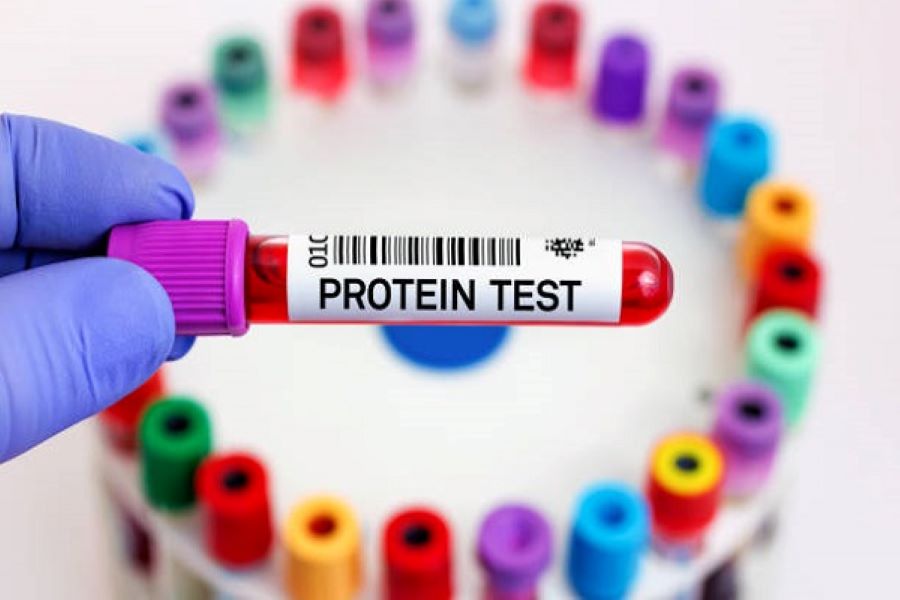 Ảnh minh họa một mẫu xét nghiệm tại Invivo Lab