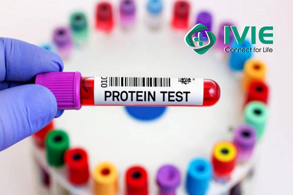 Các chuyên khoa xét nghiệm tại Invivo Lab