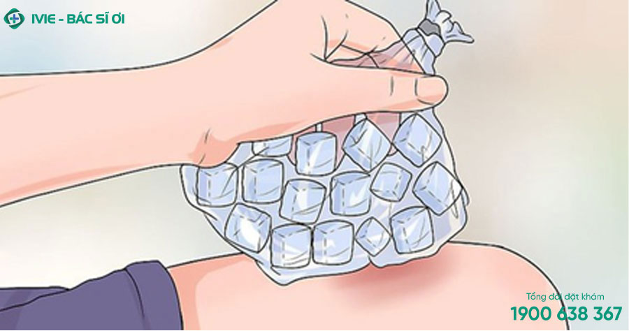 Chườm lạnh lên vết bỏng là một phương pháp sơ cứu rất hữu ích để làm giảm đau, ngứa và sưng