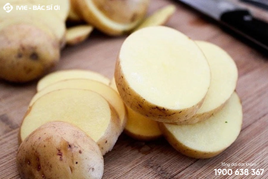 Dùng khoai tây mang đến vết bỏng