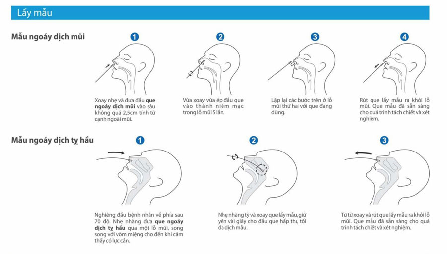 Hướng dẫn sử dụng Kit test ngoáy dịch mũi