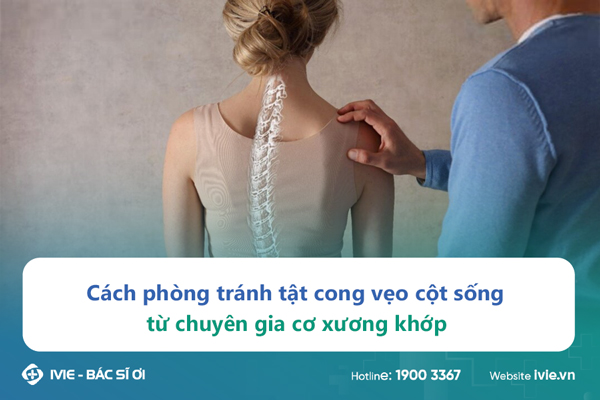 Cách phòng tránh tật cong vẹo cột sống từ chuyên gia cơ...