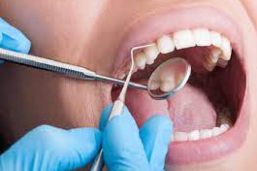  Thăm khám sức khỏe răng miệng trước khi cấy ghép