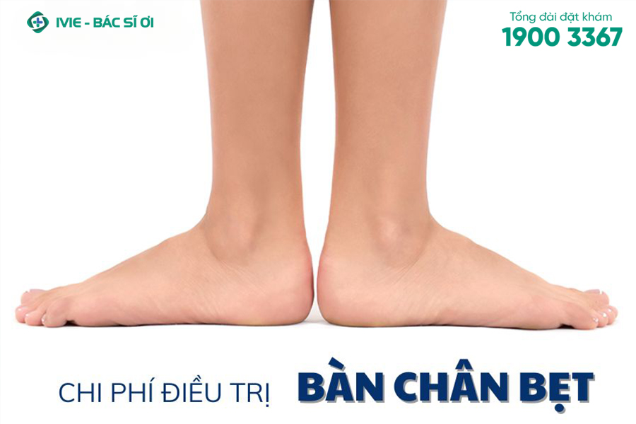 Chi phí điều trị bàn chân bẹt là bao nhiêu?