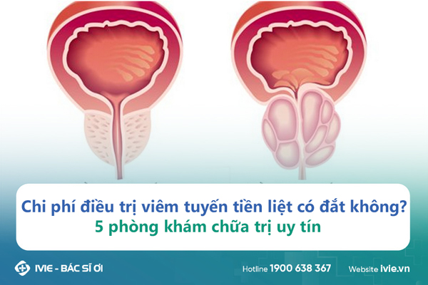 Chi phí điều trị viêm tuyến tiền liệt có đắt không? 5 phòng ...