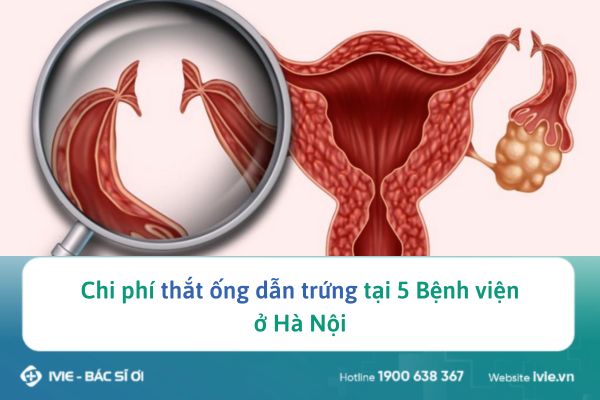 Chi phí thắt ống dẫn trứng tại 5 Bệnh viện ở Hà Nội