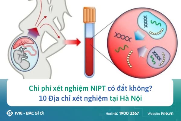 Chi phí xét nghiệm NIPT có đắt không? 10 Địa chỉ xét nghiệm ...