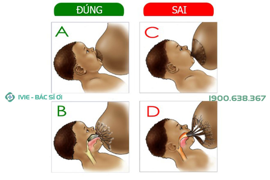 Cách cho trẻ ngậm bắt bắt vú đúng để tối ưu cách xử lý khi trẻ bị ọc sữa lên mũi