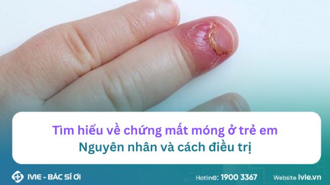 Tìm hiểu về chứng mất móng ở trẻ em: Nguyên nhân và cách...