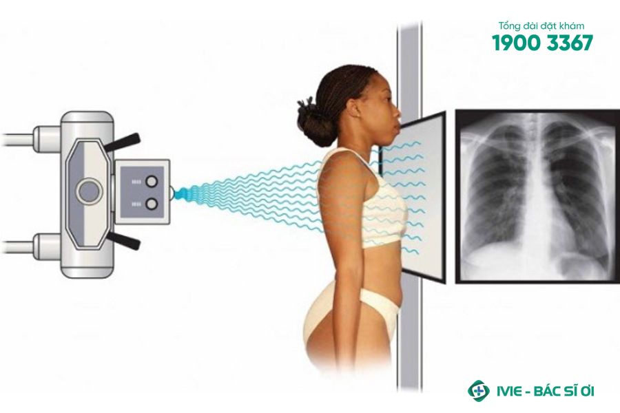 Chụp X-quang không gây hại cho sức khỏe nếu được thực hiện đúng cách