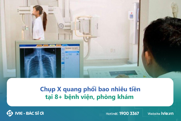 Chụp X quang phổi bao nhiêu tiền tại 8+ bệnh viện, phòng...