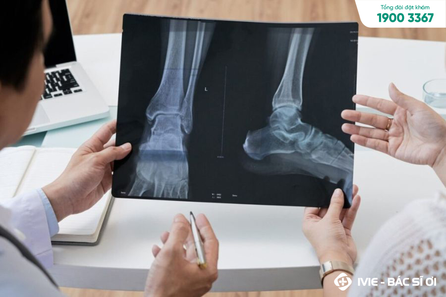 Giá chụp X quang xương khớp dao động từ 150.000 - 300.000 đồng
