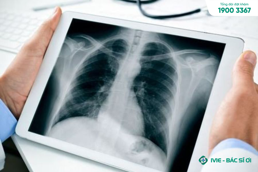 Giá chụp X-quang xương sườn bao nhiêu tiền còn phụ thuộc vào nhiều yếu tố khác nhau
