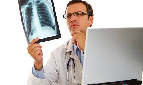 Chụp X quang tim phổi