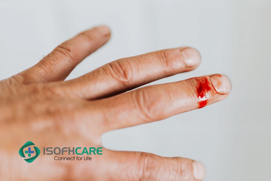 Chảy máu cam thường xuyên, máu khó đông, vết thương lâu lành,...