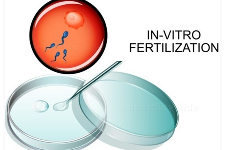 Sử dụng công nghệ hỗ trợ sinh sản như IVF