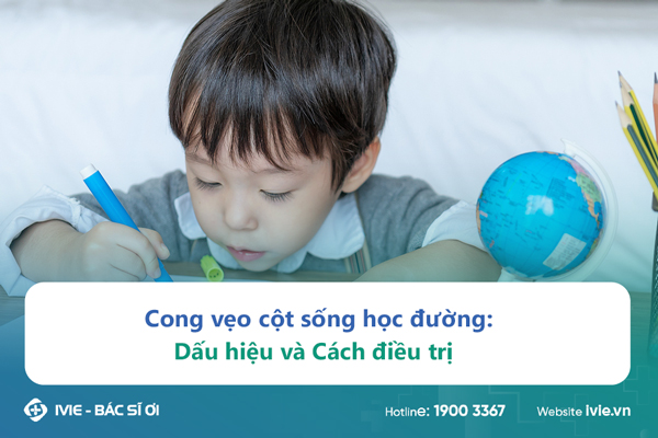 Cong vẹo cột sống học đường: Dấu hiệu và cách điều trị