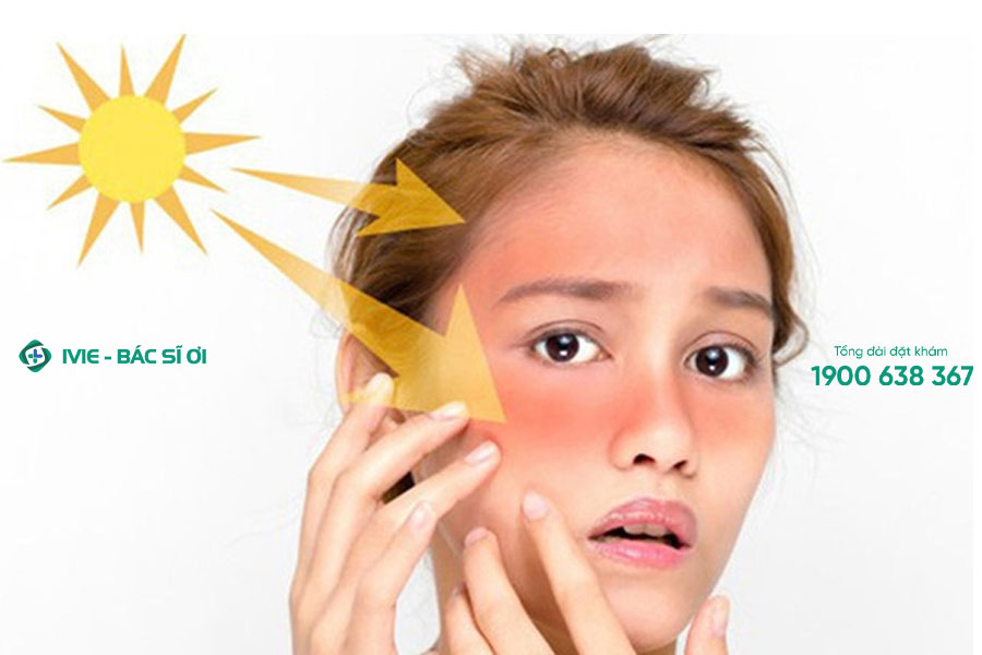 Ánh nắng mặt trời là một trong những nguyên nhân khiến da mặt bị sạm đen
