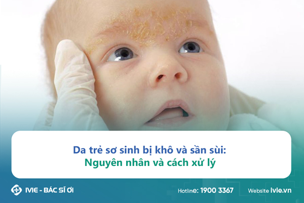Da trẻ sơ sinh bị khô và sần sùi: Nguyên nhân và cách xử lý