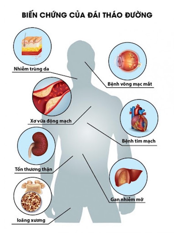 Bệnh đái tháo đường - yếu tố nguy cơ tim mạch nguy hiểm...