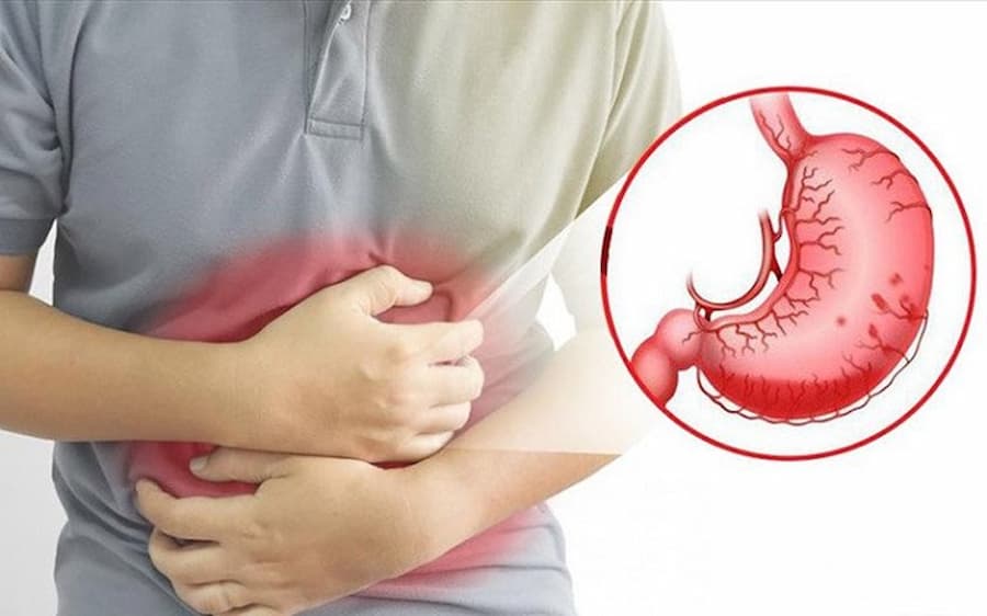 Xoa bóp bụng là phương pháp giúp làm giảm đau dạ dày bằng tác động cơ học.