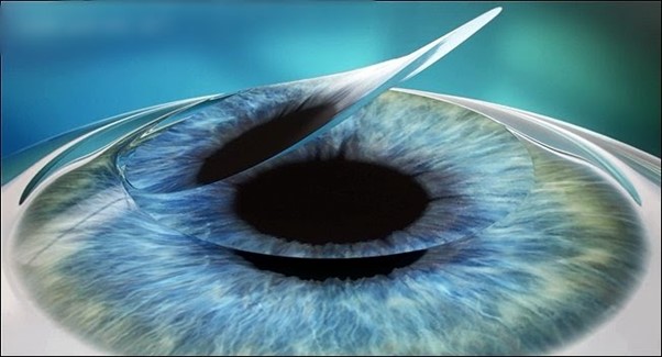 Những dấu hiệu sau mổ mắt cận