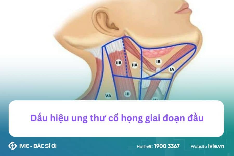 Dấu hiệu ung thư cổ họng giai đoạn đầu