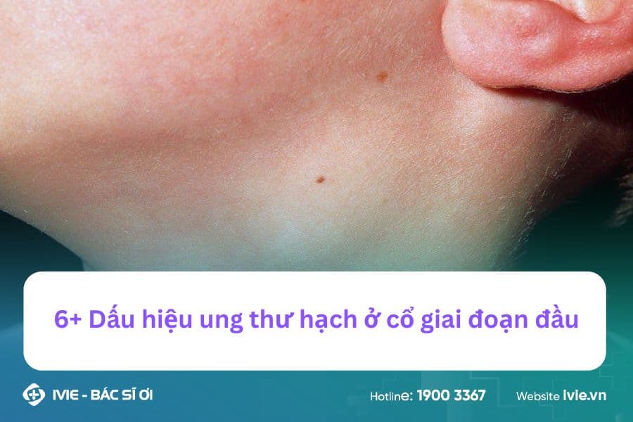 6+ Dấu hiệu ung thư hạch ở cổ giai đoạn đầu