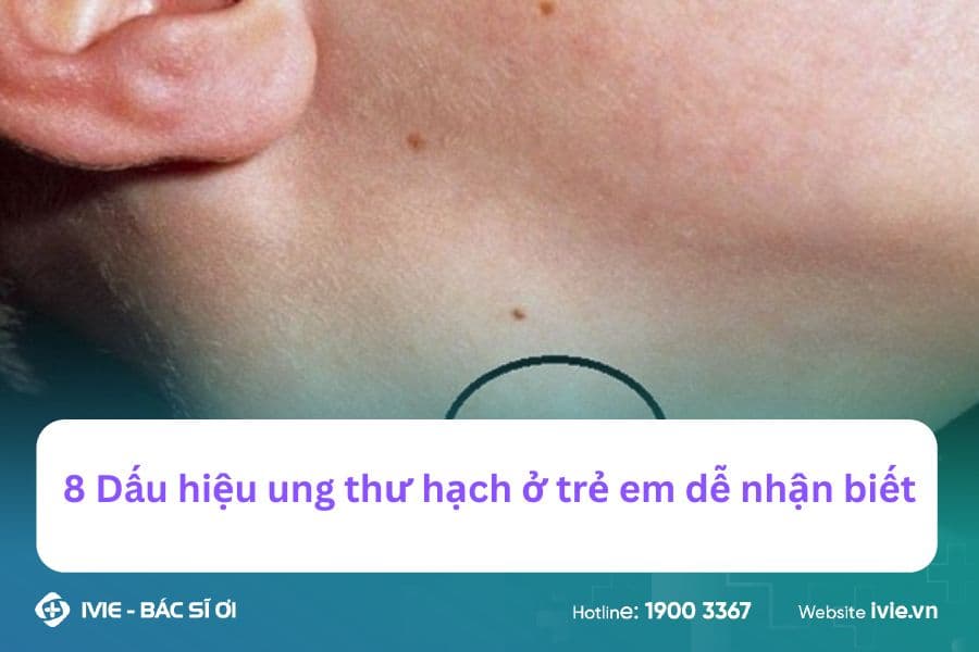 8 Dấu hiệu ung thư hạch ở trẻ em dễ nhận biết