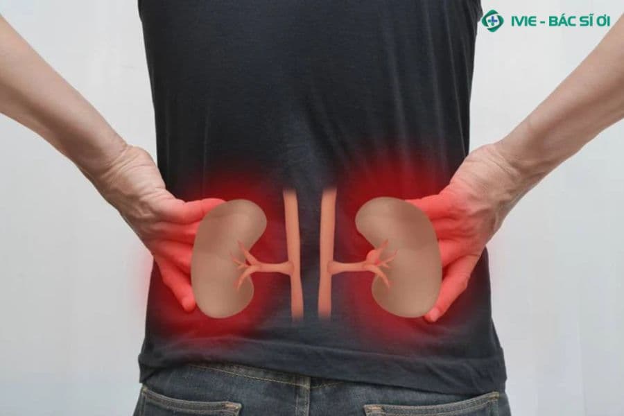 Dấu hiệu ung thư thận giai đoạn đầu
