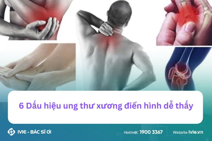 6 Dấu hiệu ung thư xương điển hình dễ thấy