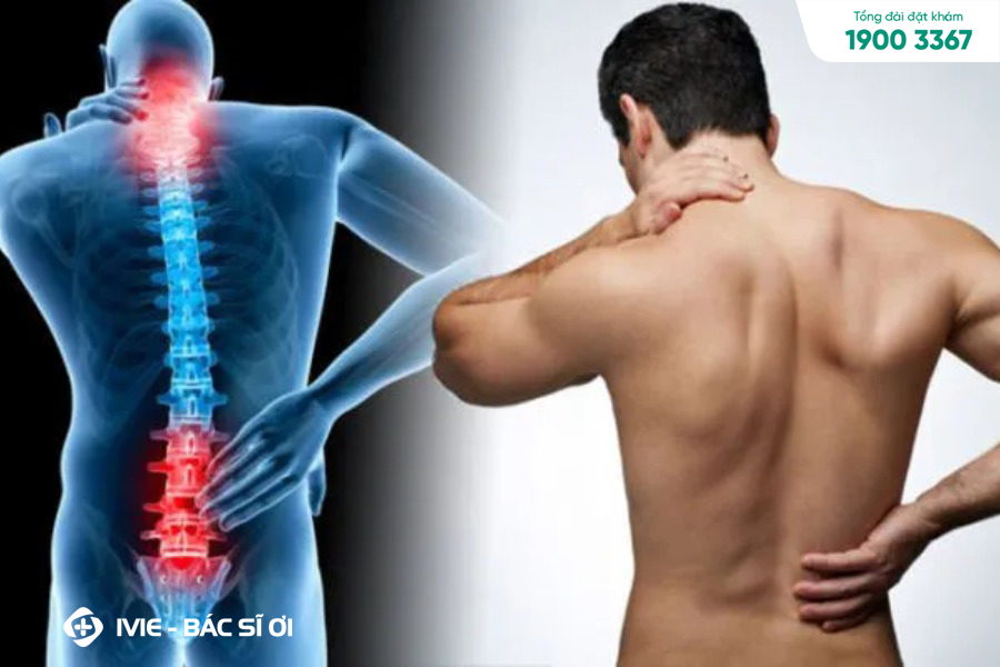 Bị đau vai gáy là triệu chứng của bệnh vôi hóa cột sống