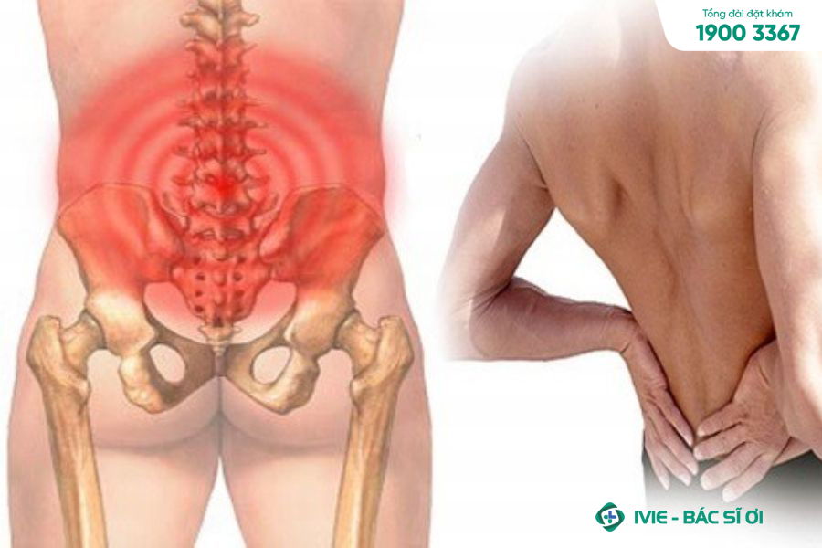 Bạn nên thay đổi tư thế, duỗi cơ để điều trị đau xương cụt khi ngồi 