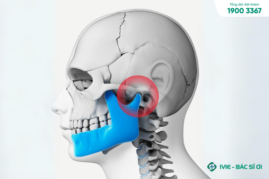 Đau xương hàm bên phải là dấu hiệu bệnh sái quai hàm