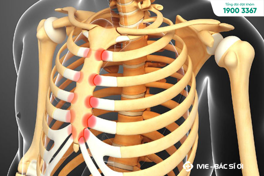 Viêm xương ức gây nên những cơn đau ở vùng xương ngực