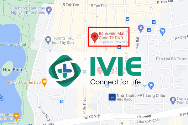 Địa Chỉ Bệnh Viện Mắt Quốc tế DND Hà Nội Ở Đâu?