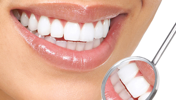 Tẩy trắng răng tại nhà - Phòng khám Nha khoa CDENTAL 