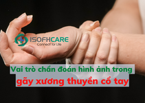 Có những biến chứng nào có thể xảy ra sau khi gãy xương thuyền cổ tay không được điều trị đúng cách?
