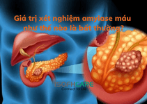 Giá trị xét nghiệm amylase máu như thế nào là bất thường?