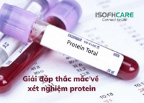 Giải đáp thắc mắc về xét nghiệm protein